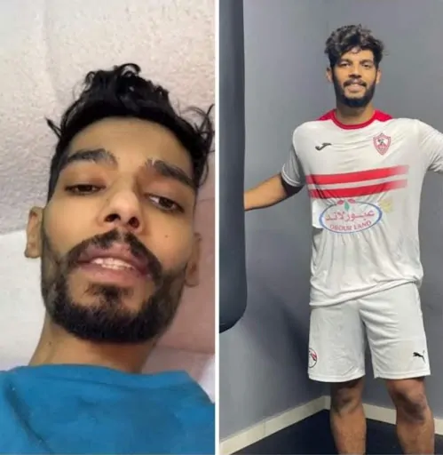 أعضاء اللاعب شيكا