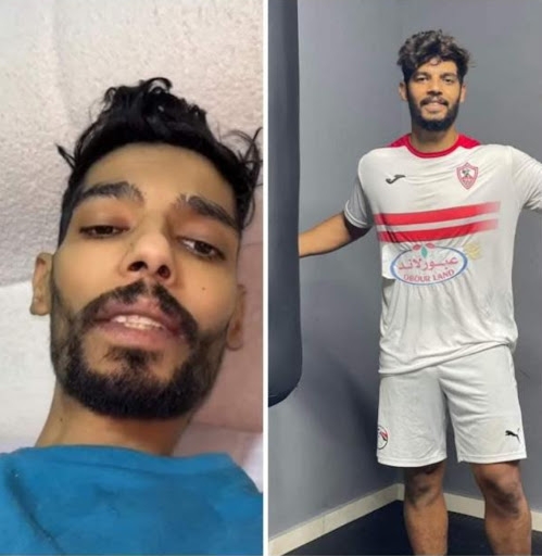 أعضاء اللاعب شيكا
