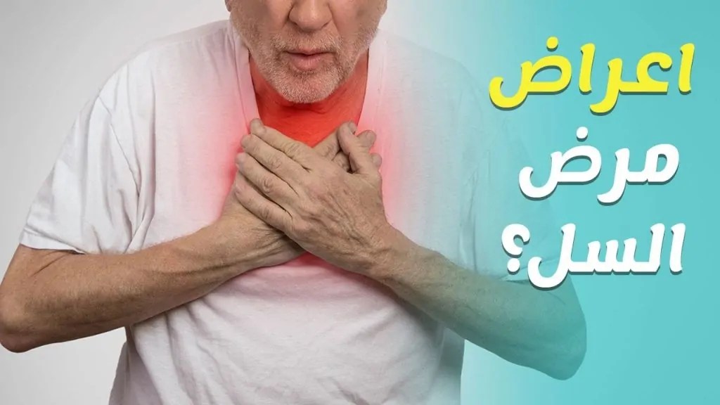 7 معلومات عن مرض السل عقب ظهوره في الولايات المتحدة الأمريكية 3 مرض السل