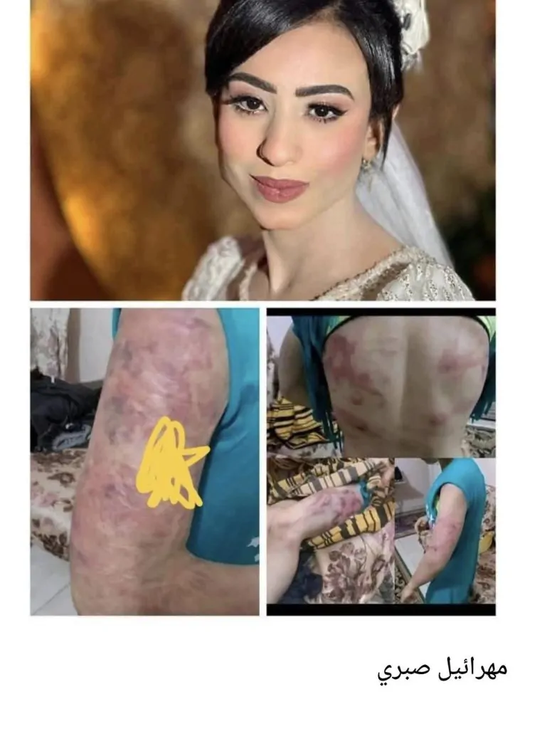 مهرائيل صبري عروس بني سويف ضحية العنف الأسري وزيرة التضامن تستجيب للكاتبة سحر الجعارة 3 مهرائيل صبري