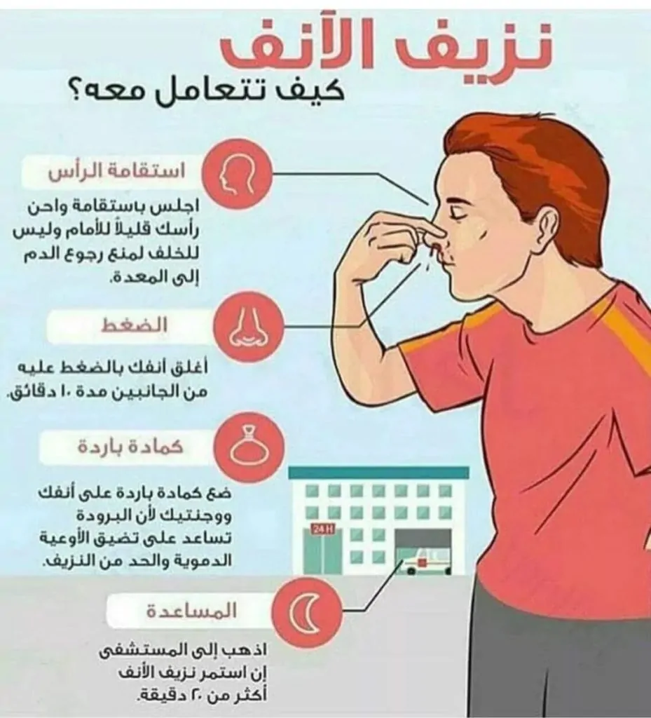 تعرف على أسباب نزيف الأنف والأشخاص الأكثر عرضة له 4 نزيف الأنف