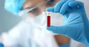 اكتشاف بالصدفة فصيلة دم جديدة لأول مرة منذ سنوات والسبب جسم مضاد غامض 3 فصيلة دم جديدة