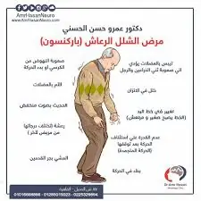 شلل الرعاش ننشر مضاعفات وأعراض مرض الفنان يوسف فوزي يبدأ بعلامة في اليد وتكتشفه أثناء المشي 2 مرض شلل الرعاش