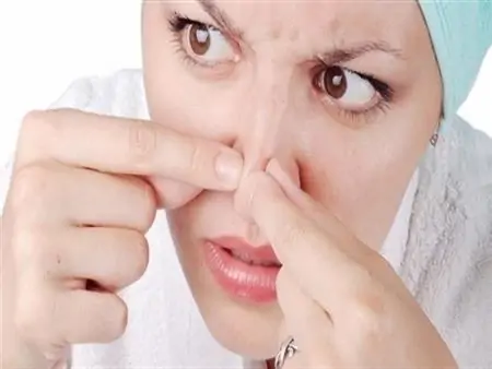 تعدى سريعا استشاري يحذر من انتشار الحبوب الجلدية يعد علامة على إرهاق الكلى 4 استشاري يحذر من انتشار الحبوب الجلدية