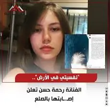 قلبى مكسور بالصور الفنانة رحمة حسن تعلن عن معاناتها الصحية لأول مرة بعد إصابتها بالصلع 3 الفنانة رحمة حسن تعلن إصابتها بالصلع