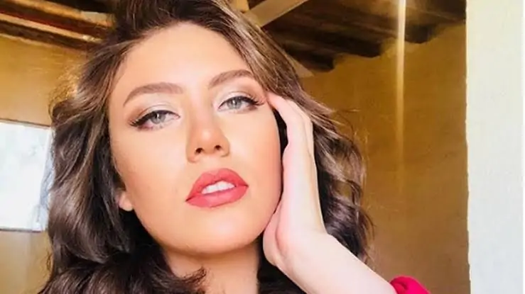 قلبى مكسور بالصور الفنانة رحمة حسن تعلن عن معاناتها الصحية لأول مرة بعد إصابتها بالصلع 4 الفنانة رحمة حسن تعلن إصابتها بالصلع