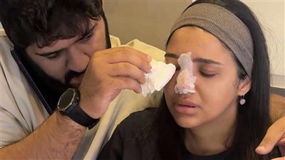 مناخيري كانت هتروح بسبب حقنة فيلر