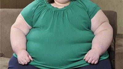 هل العالم  على أعتاب«ثورة علاجية للسمنة والسكر النوع الثاني»؟