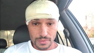 10 غرز في رأس عوكشة مهاجم هيلوبوليس بعد الإصابة في لقاء الجزيرة بالقسم الثالث