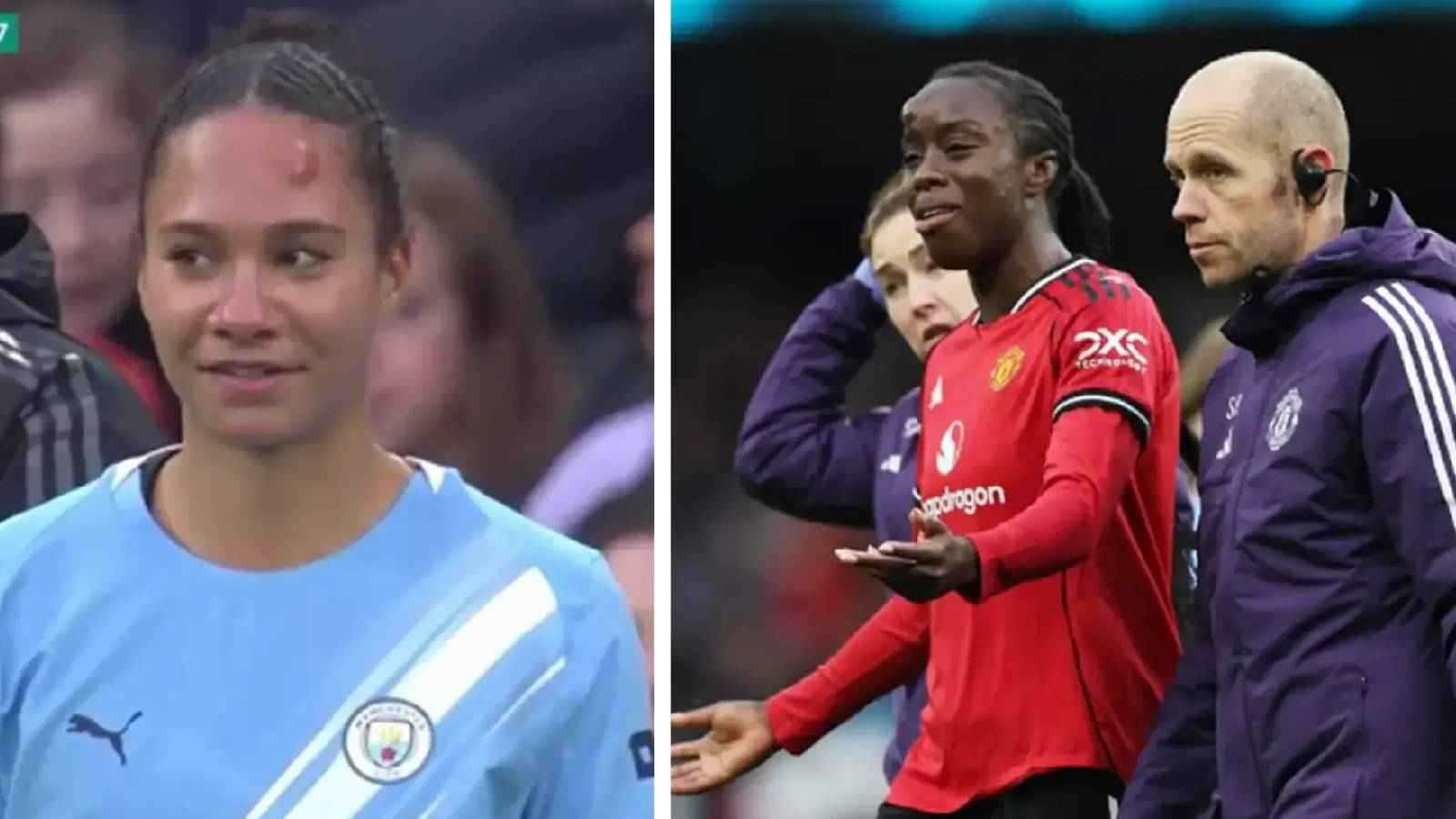 صدام مرعب بين لاعبتين في ديربي مانشستر (فيديو)