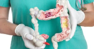 4 عوامل بيئية تزيد خطر الإصابة بسرطان الأمعاء وطرق الوقاية