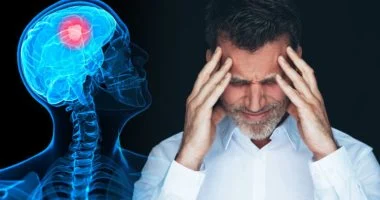 5 عوامل تزيد خطر الإصابة بسكتة دماغية ثانية بعد التعافي