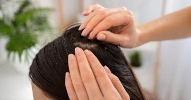 اكزيما فروة الرأس: علاماتها وطرق علاجها الفعالة