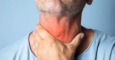 التهاب الحلق المتكرر: أسباب خفية تتجاوز العدوى