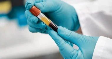 الحجاج: تطعيمات أساسية للفحص الطبي تجنبكم الأمراض