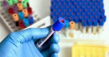 الهيموفيليا السعال المزمن: 8 أسباب وراء الألم الصحي الذي يجب الانتباه له