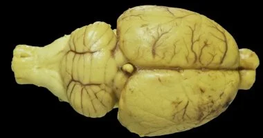 باحثون يدربون خلايا عصبية حية لمهام الذكاء الاصطناعي البيولوجي