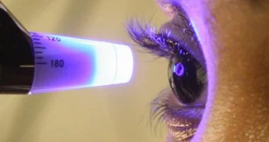 تلف العين الصامت: كيف يحطّم السكري بصرك وكيف تحميه