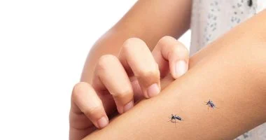 خبراء يكشفون أسباب انتشار الذباب والنموس مع ارتفاع الحرارة وطرق مواجهته بالبدائل الطبيعية