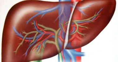 علاج إشعاعي موجه يحدث طفرة بعلاج سرطان الكبد ويوفر على نفقة الدولة