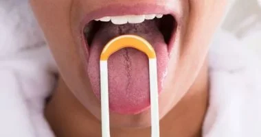 ماذا يقول لون لسانك عن صحتك؟.. علامات قد تكشف مشاكل داخل جسمك