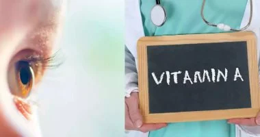 8 أطعمة غنية بفيتامين أ لصحة العين والعظام