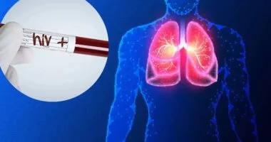 أول عملية زرع رئة فى العالم بين شخصين مصابين بفيروس نقص المناعة البشرية