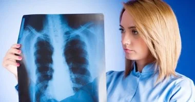 اختبار دم جديد يظهر نتائج واعدة فى التنبؤ بسرطان الرئة قبل ظهوره