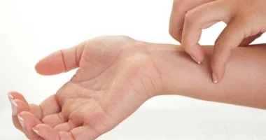 تجنب حك الجلد.. دراسة توضح طرق التعامل الصحى مع لدغات الحشرات