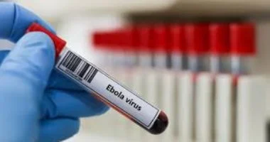 ظهور إيبولا فى 3 مناطق جديدة بالكونغو وتسجيل 676 إصابة و136 وفاة