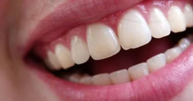 لا تتجاهل تورم اللثة.. الأسباب وطرق العلاج والوقاية